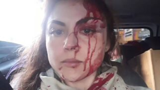 Gabriela Samadello Monteiro de Barros minutos depois de ser espancada