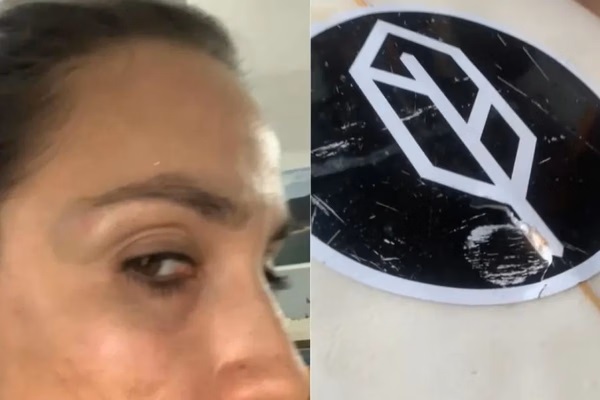 Surfista agredida em Bertioga, no litoral paulista