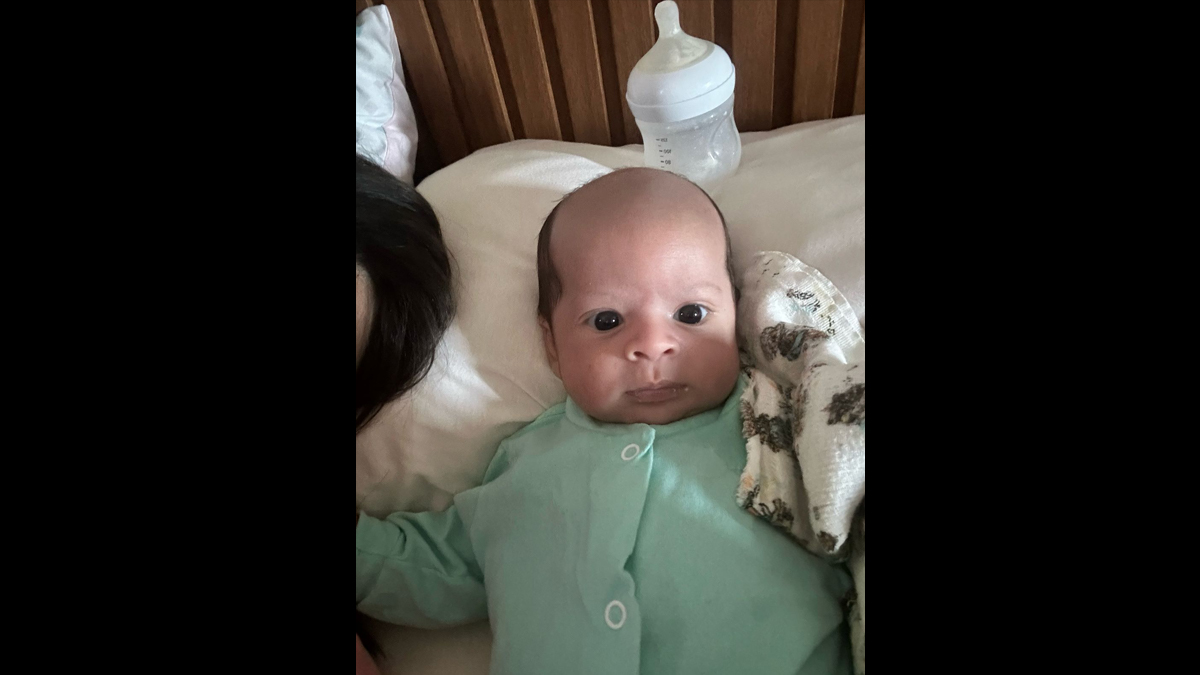 Pedro, o bebê de apenas nove meses, nasceu com um visual inusitado/ Arquivo Pessoal