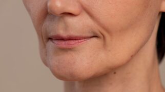 Descubra o segredo para uma pele mais lisa: massagens que combatem o bigode chinês