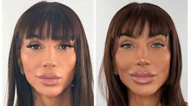 Maya Massafera passou por uma ceratopigmentação a laser com femtosegundo, um dos métodos mais modernos e menos invasivos