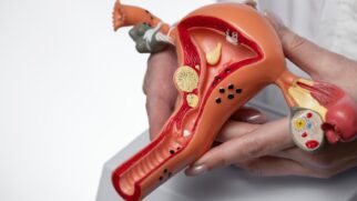 Novo teste caseiro promete cortar gastos e sofrimento de anos de espera no diagnóstico da endometriose