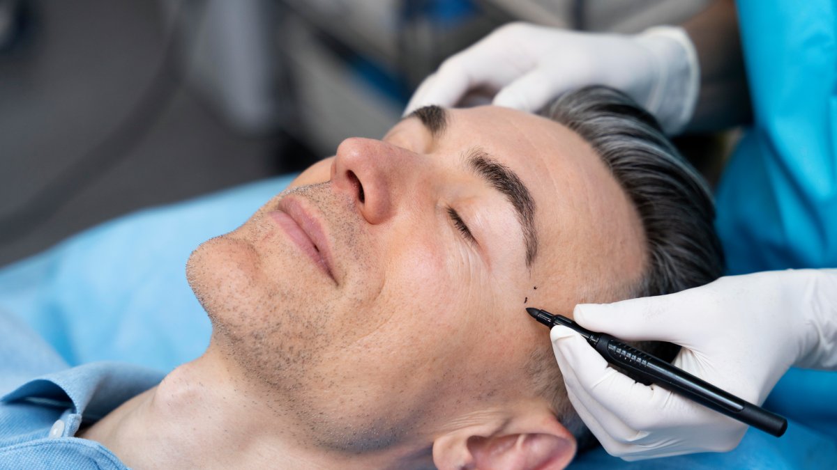 Por que os homens estão investindo pesado em procedures como lipo e rinoplastia?