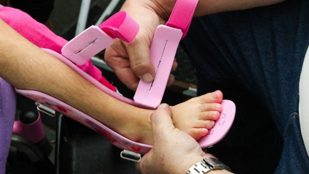 O tratamento da menina é garantido pelo Sistema Único de Saúde (SUS)