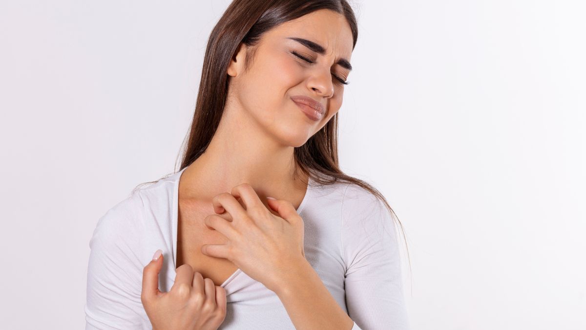 As reações alérgicas aos ácaros podem vir em sintomas respiratórios (rinite e/ou asma e/ou conjuntivite) ou lesões cutâneas (vermelhidão e coceira) - Pexels