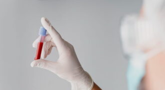 Atualmente, existe apenas um exame de sangue aprovado pela FDA nos EUA para auxiliar no diagnóstico do Alzheimer