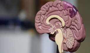 De acordo com a Anvisa, os estudos clínicos mostraram que o medicamento é mais eficaz nos estágios iniciais da doença