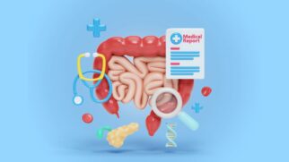 Hábitos simples, como comer bem e se exercitar, ajudam a manter o intestino saudável e equilibrado