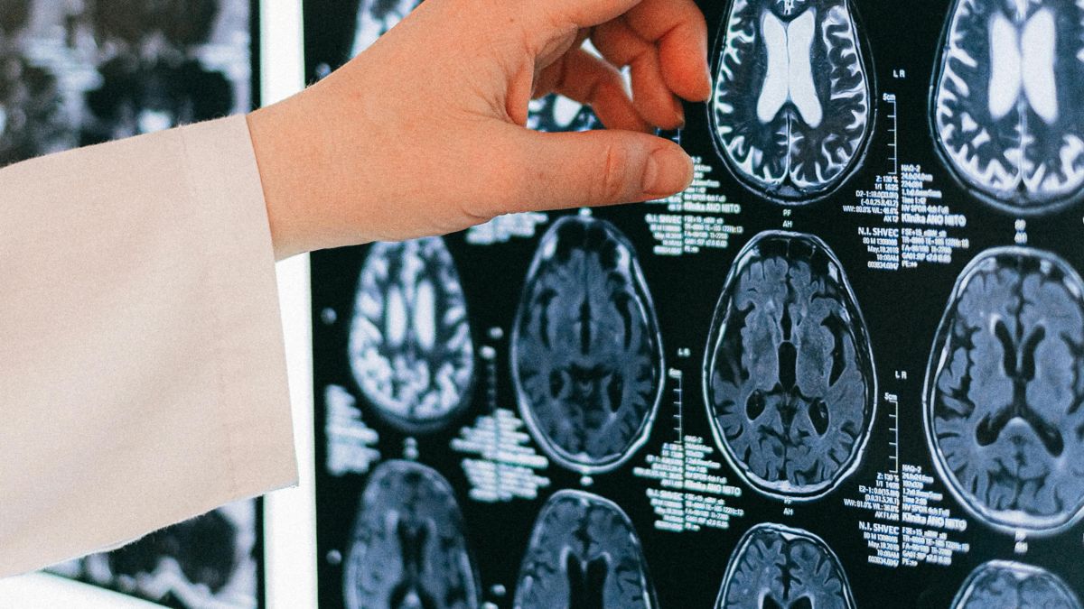 4 - Já foram encontrado plásticos dentro do corpo humano e até mesmo no cérebro - Pexels