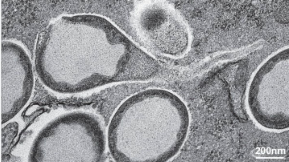 Microscopia crioeletrônica permite observar a estrutura detalhada do vírus e suas interações com o hospedeiro / Artigo publicado na revista Nature.