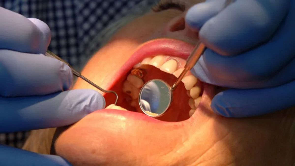 Novo gel criado por cientistas promete clarear e limpar os dentes mais rápido