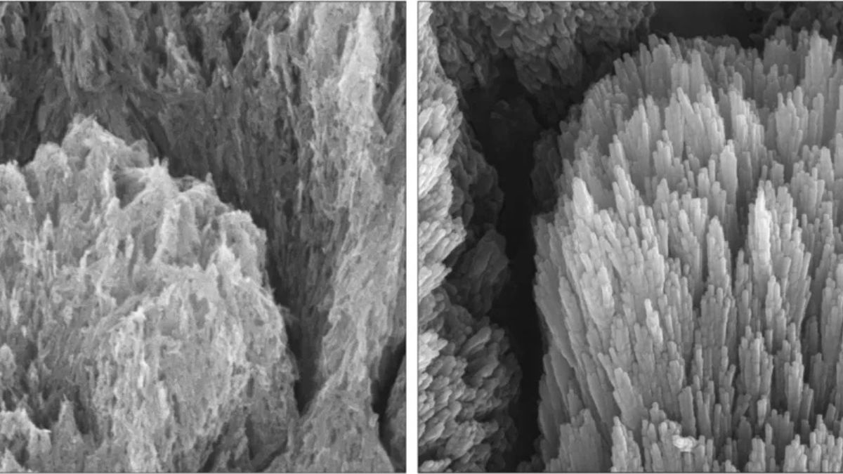 Novo gel criado por cientistas promete clarear e limpar os dentes mais rápido