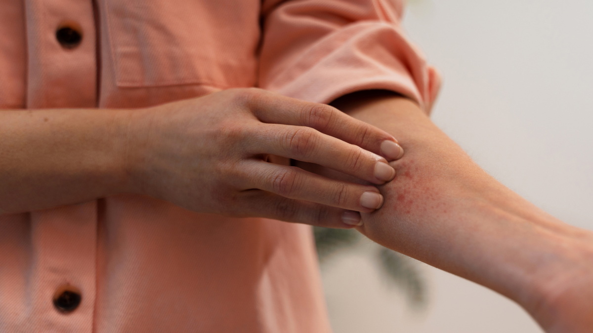O problema costuma atingir áreas mais expostas, como braços, mãos, rosto, pescoço e peito
