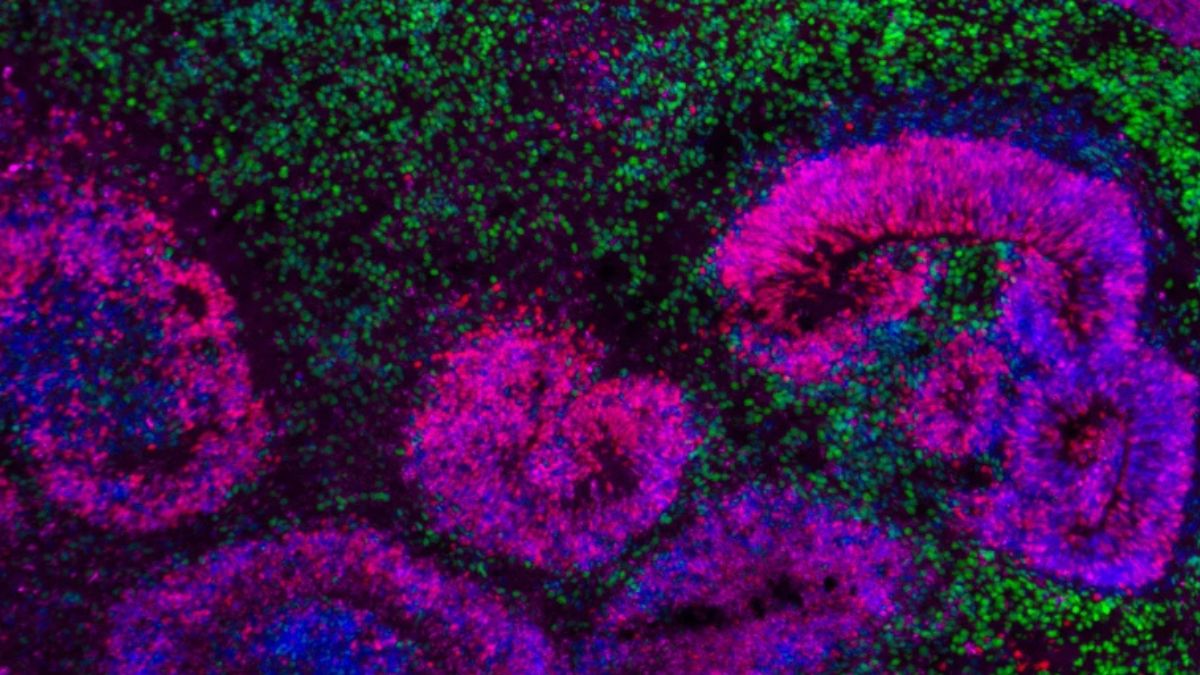 Novo mapa celular desvenda formação do cérebro de mamíferos