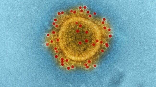 Após a infecção de dois profissionais da saúde, cerca de 110 pessoas foram colocadas em quarentena no estado de Bengala Ocidental, como medida preventiva contra o vírus Nipah