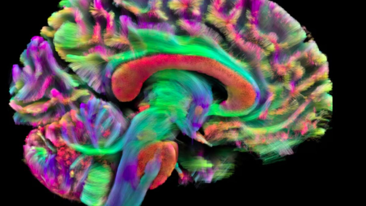 Na infância, o cérebro realiza uma verdadeira 'poda neural': conexões pouco utilizadas são eliminadas para dar lugar a circuitos mais rápidos e eficientes, essenciais para o aprendizado e a memória/Foto de Mark and Mary Stevens Neuroimaging and Informatics Institute, SCIENCE PHOTO LIBRARY