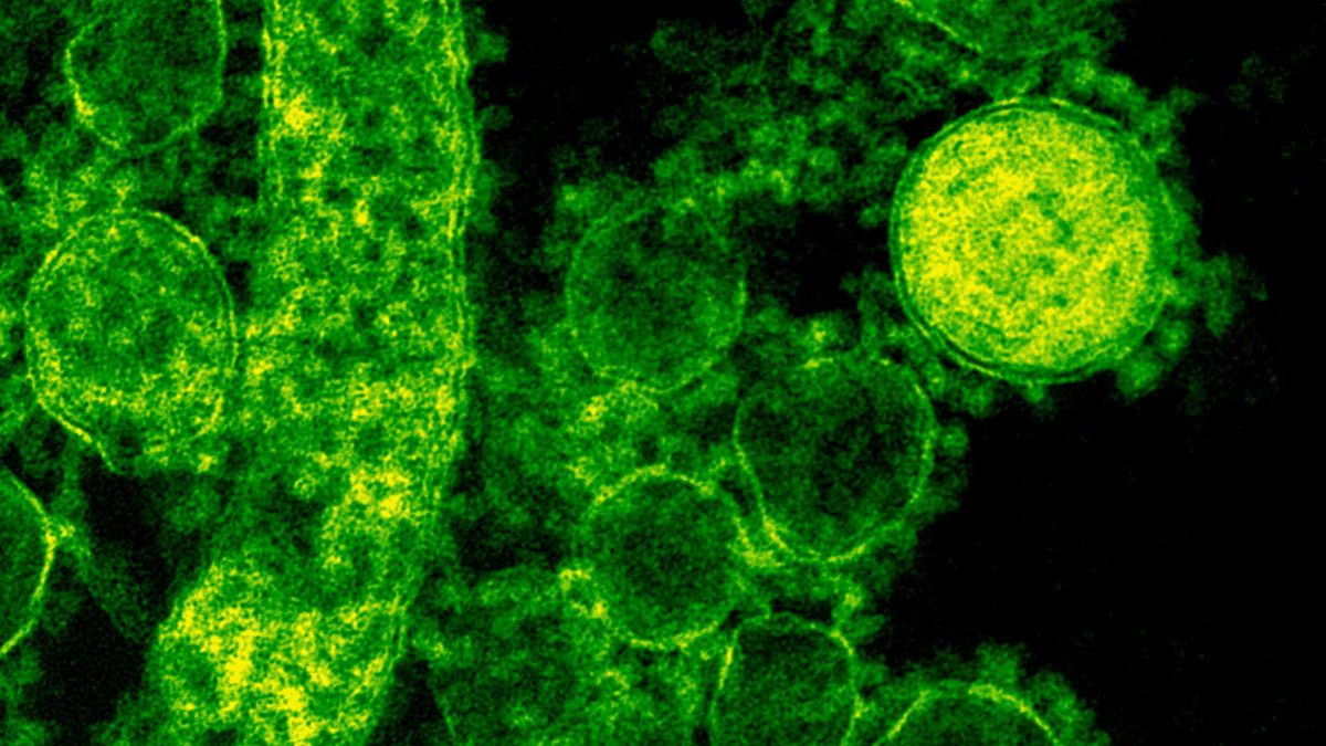 Cientistas monitoram potencial epidêmico do vírus Nipah após novos casos em profissionais de saúde/Pexels