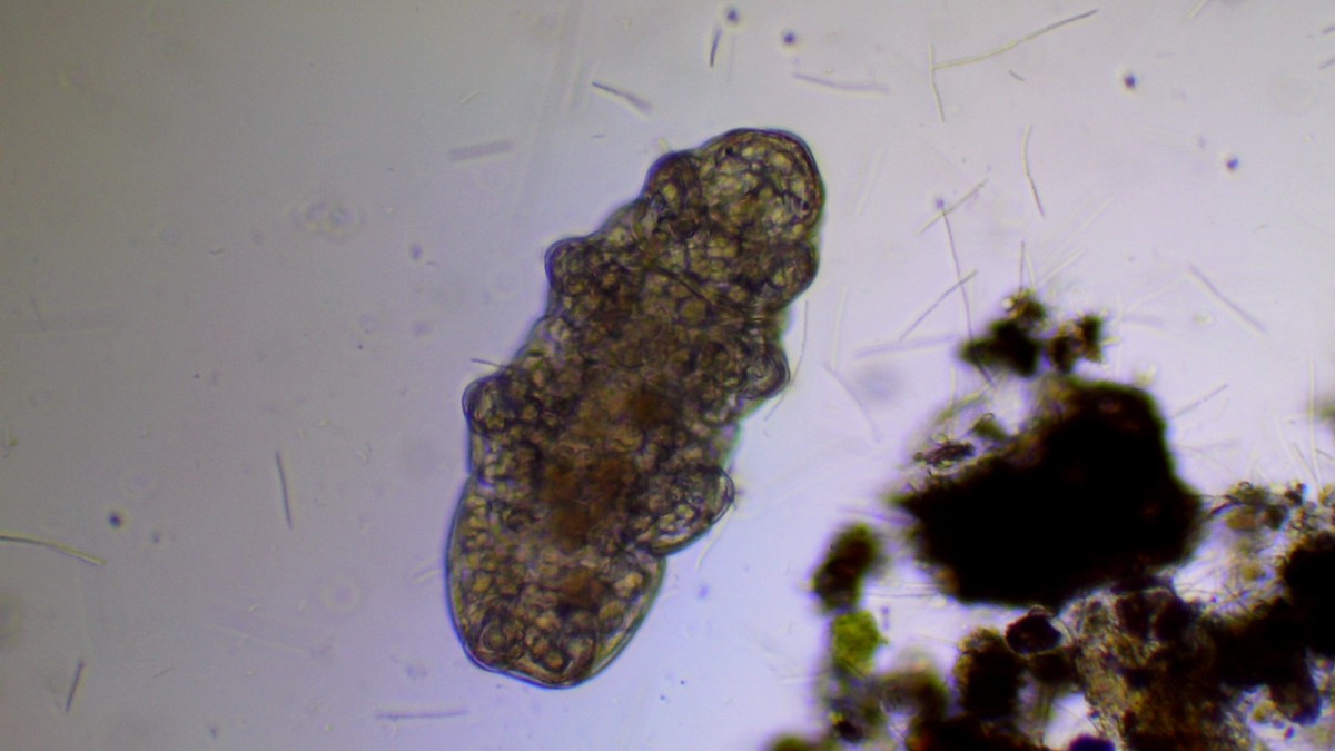 Esses animais microscópicos habitam desde oceanos profundos até musgos e líquens / Dmitry Brant/Wikimedia Commons