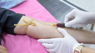 Santos já teve outros registros de pessoas contaminadas com Mpox