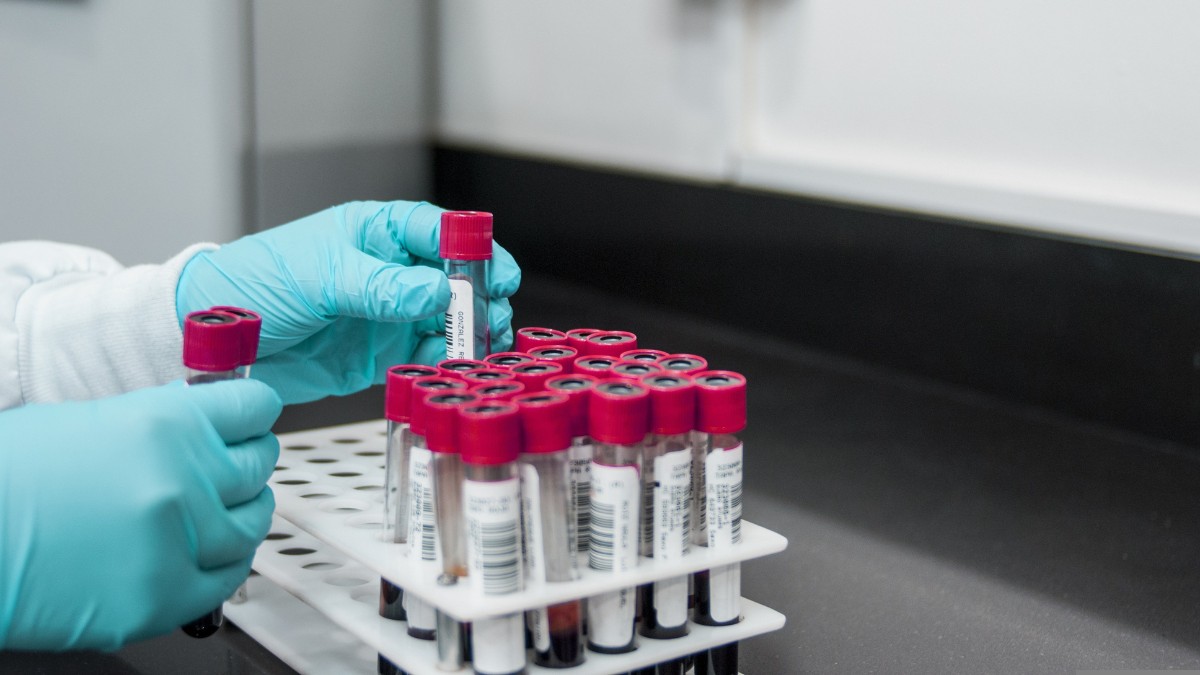 O exame de sangue auxilia na detecção precoce de diversas doenças / Pixabay