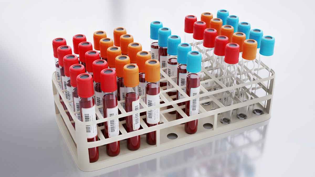 Resultados laboratoriais orientam tratamentos e decisões clínicas / Pixabay