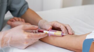 Pesquisas indicam que biomarcador sanguíneo detecta alterações cerebrais do Alzheimer antes do estágio avançado da doença