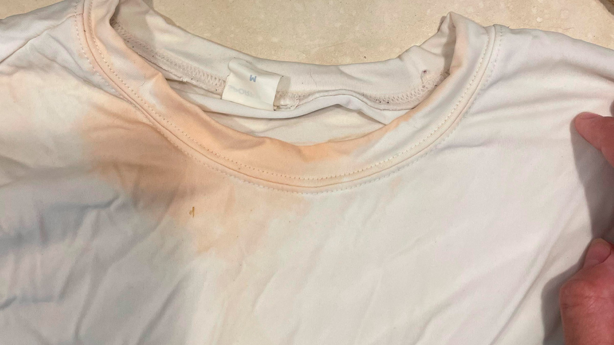 A dica que viralizou nas redes sociais promete acabar com uma das manchas mais comuns do verão