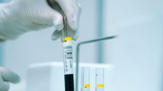 A hipocalemia consiste em uma alteração clínica pela baixa concentração de potássio no sangue, reforçando a importância do elemento