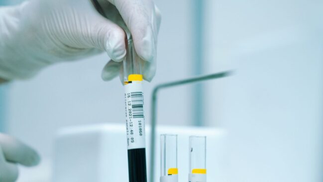 A hipocalemia consiste em uma alteração clínica pela baixa concentração de potássio no sangue, reforçando a importância do elemento