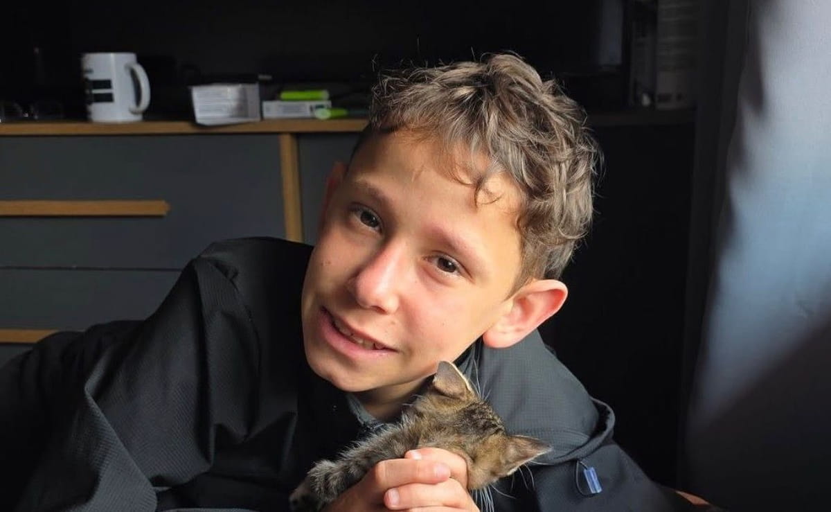 Conhecido como Jhonny, ele chamou atenção ao revelar o motivo por trás da aparência incomum: uma condição rara chamada Síndrome de Mauriac